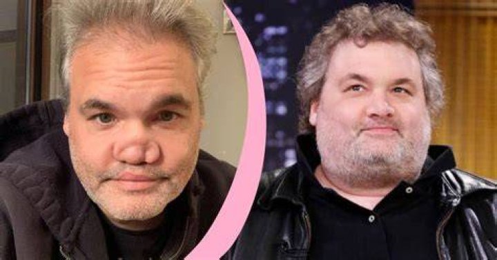 What Happened to Artie Lange's Nose: A Deep Dive into His Journey